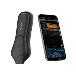 C10MB Pro USB&Wifi high-frequency linear ultrasound probe