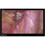 4K UHD 32 inch* Premium-quality Surgical Monitor MS322PB