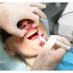 Berylas Diode Dental Laser with Three Wavelengths 450nm 650nm 980nm in Laser Dentistry