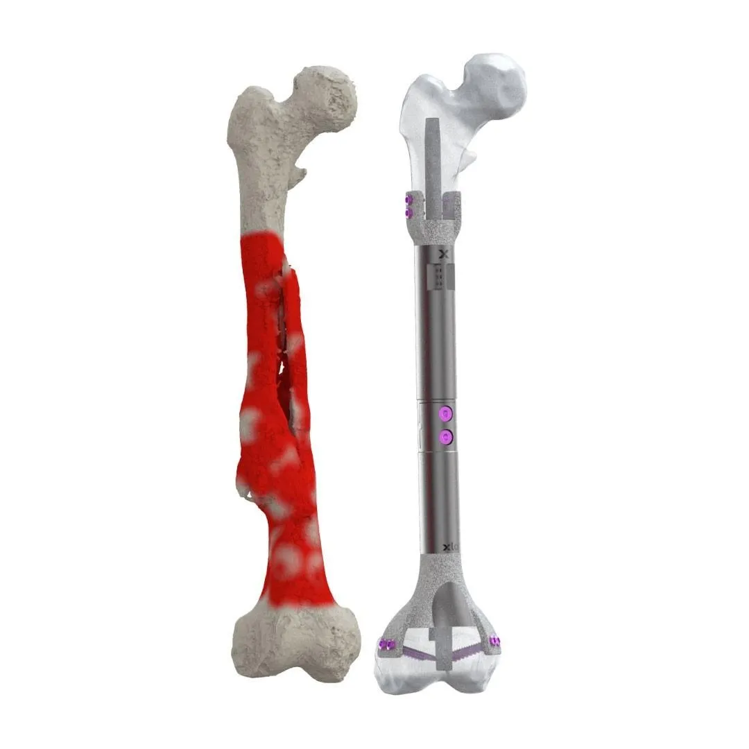 xl-creations - Patient Specific Implant Systems