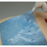 Blu® Smart Advanced Wound Dressings