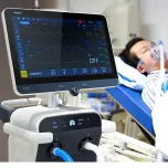 ICU Ventilator VK600