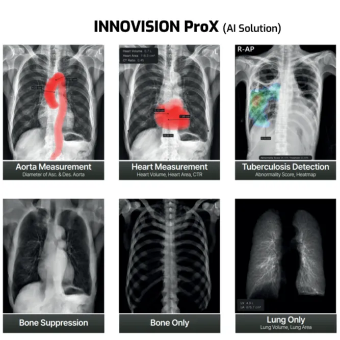 INNOVISION ProX