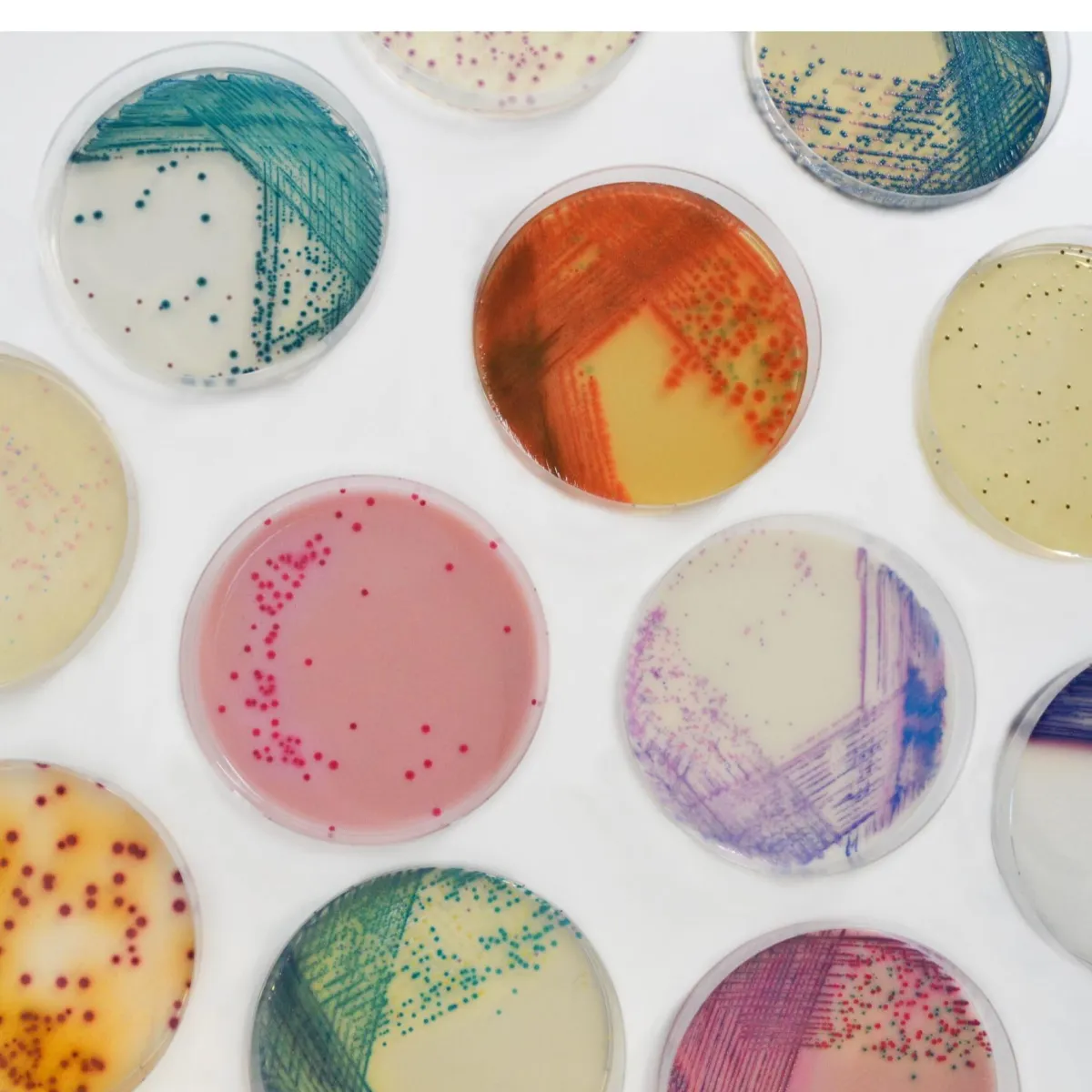 Chromogenic Culture Medias