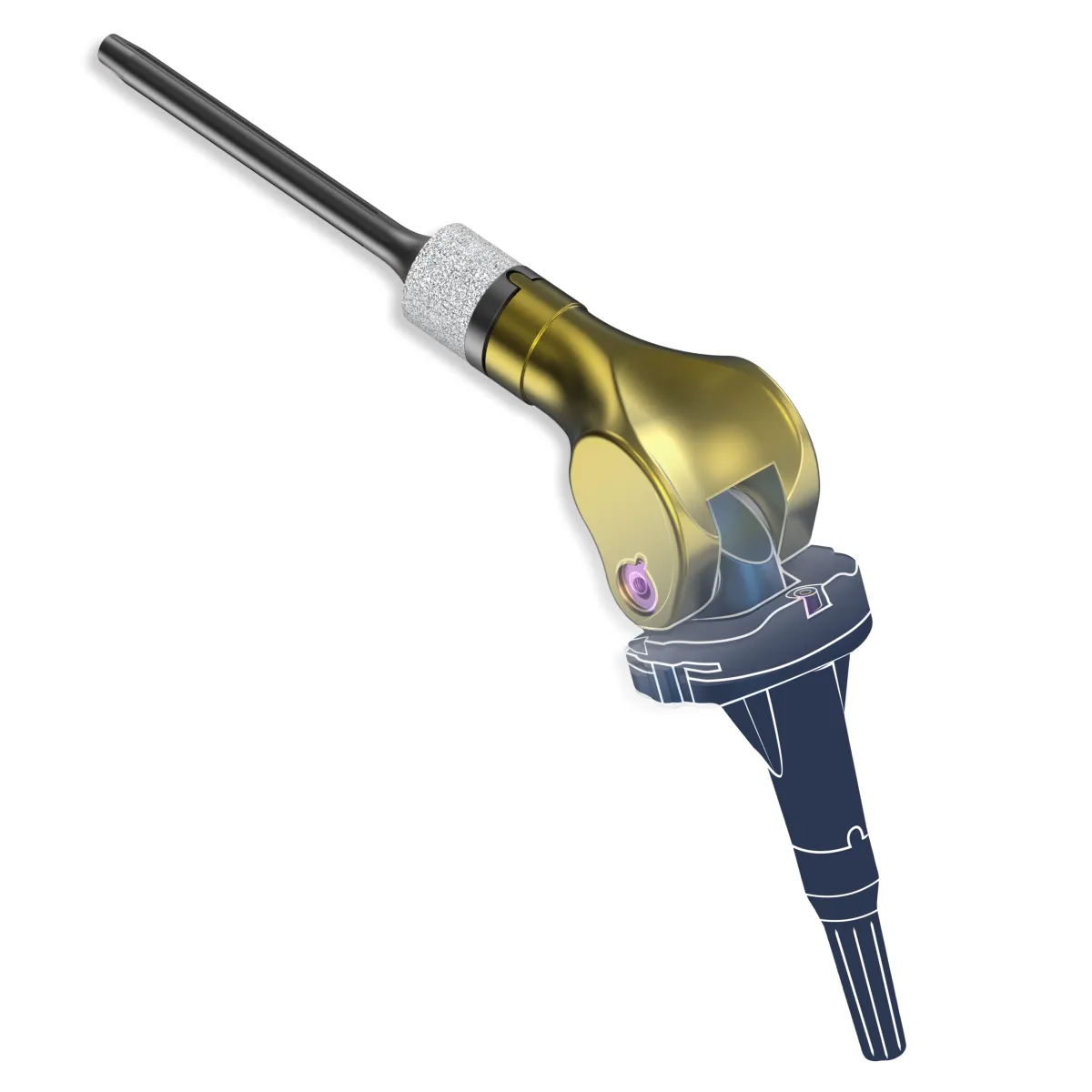XL-Momentum Knee Replacement System