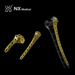 Orthopedic Implant for Trauma
