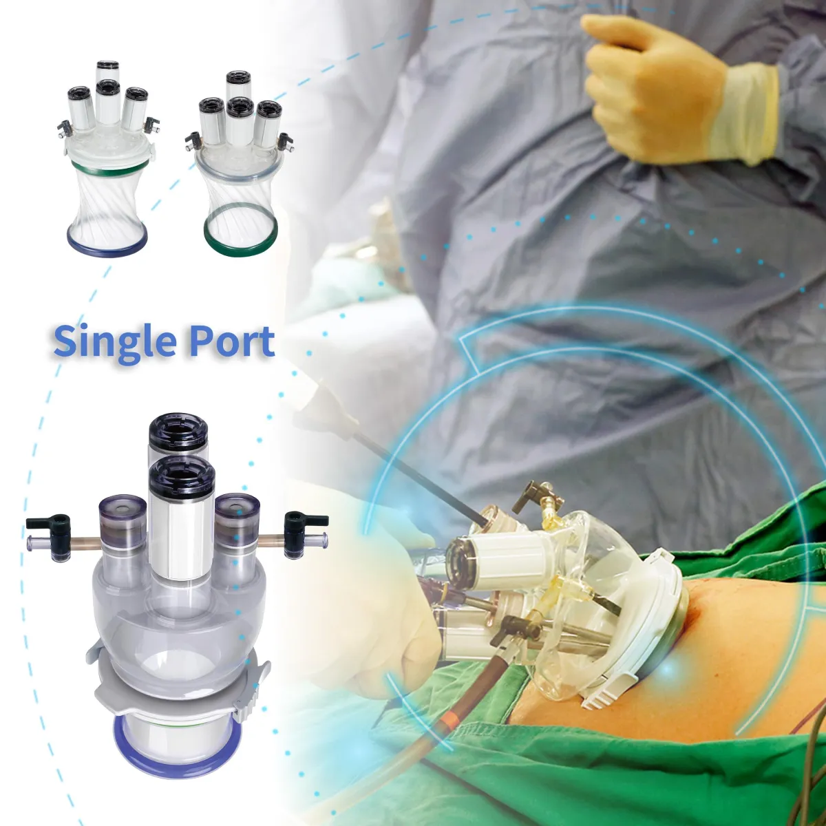 LAGIS Single Port Acess