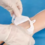 Wound Dressing, Transparent Dressing