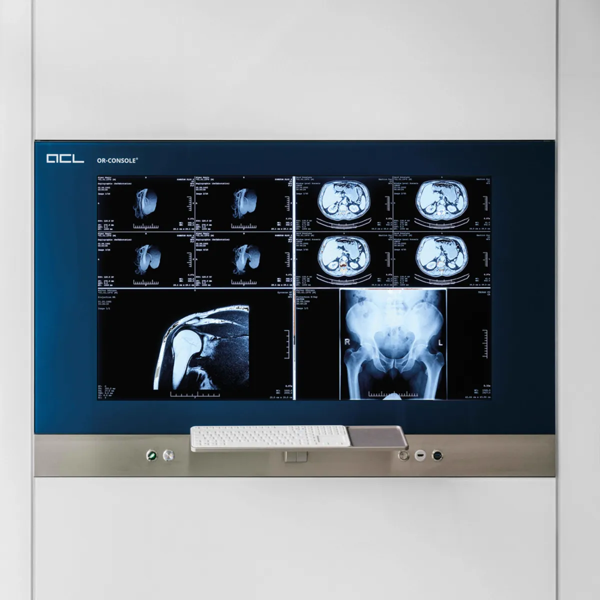 ACL OR-CONSOLE® - medical workstations in OR