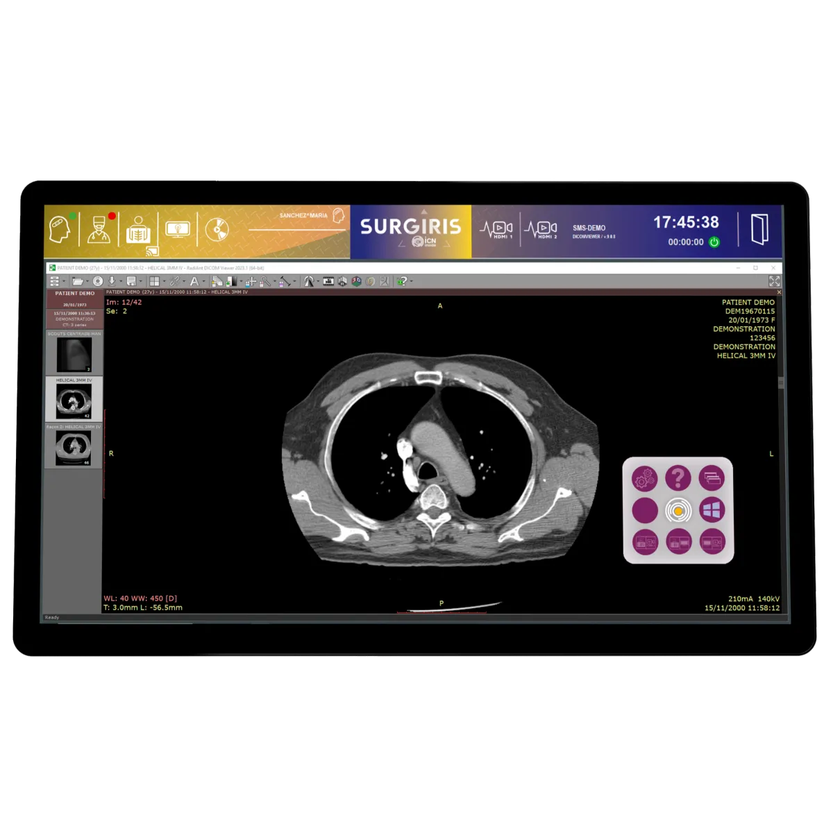 DICOM Viewer 55'' station - PACS Consultation viewing monitor