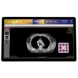 DICOM Viewer 55'' station - PACS Consultation viewing monitor