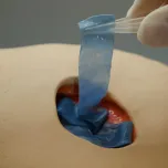 Blu® Smart Advanced Wound Dressings
