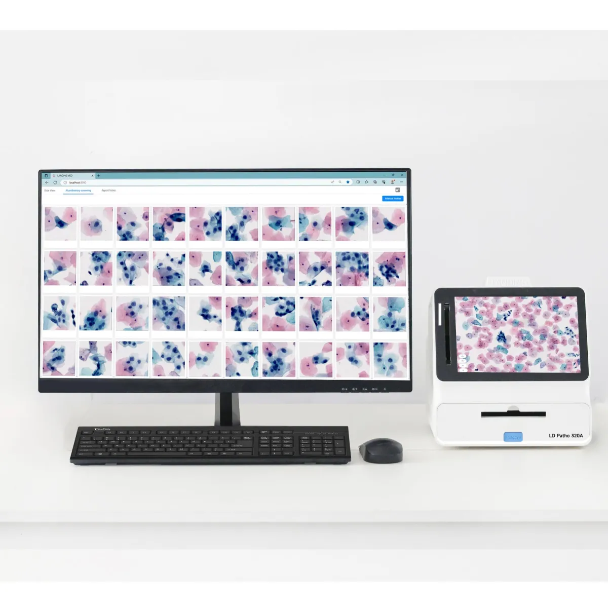 AI-powered Cervical Cytology System