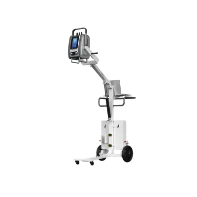 Portable X-ray system | SONTU100-POR-I
