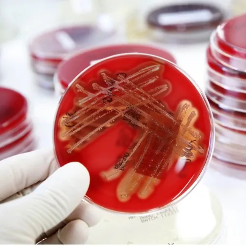 Microbiological analyzes
