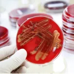 Microbiological analyzes
