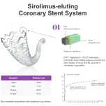 Vita Sirolimus-eluting Coronary Stent System