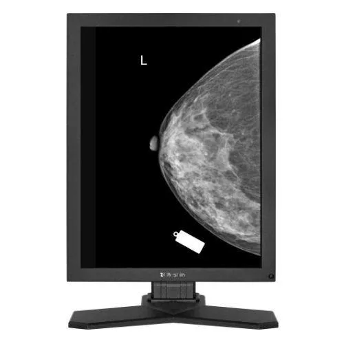5MP 21.3 inch* High-Precision Diagnostic Gray Monitor MD52G