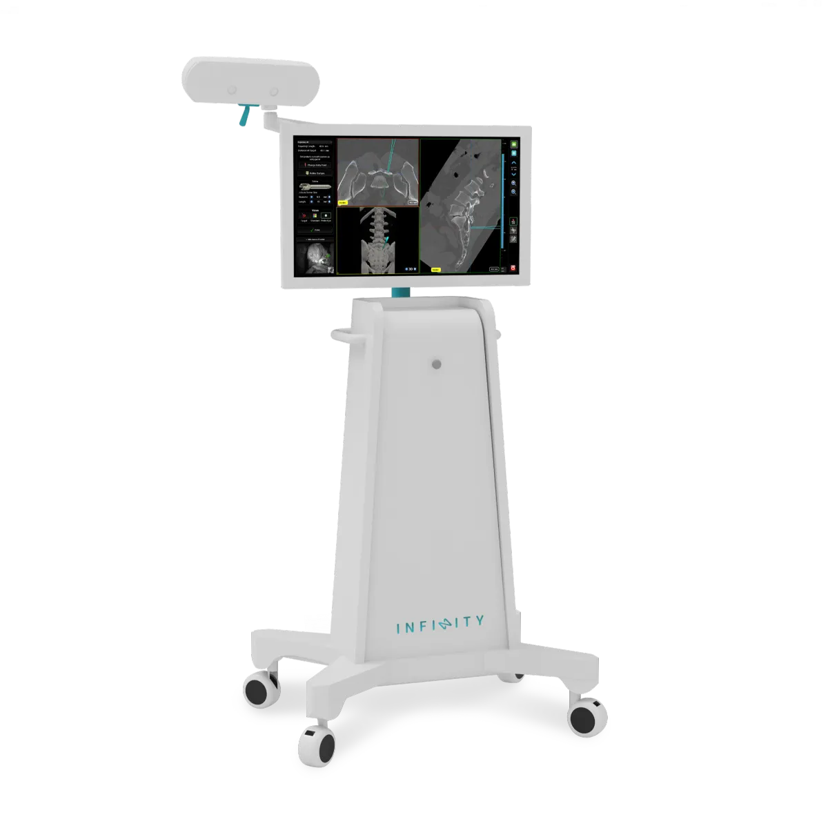 easyNav Surgical Navigation System