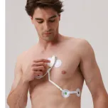 ECG ambulatorial