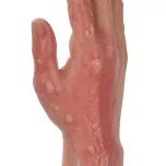 Severe Full silicone Arm Burn care training simulator