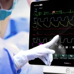 AnyView P18 Patient Monitor