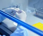 Analytical Development