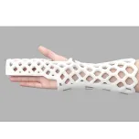 A shower-friendly odor and itch free orthopedic cast allows for skin monitoring and quick to apply