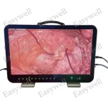 ALL IN ONE FHD and 4K IMAGE SYSTEM FOR ENDOSCOPE