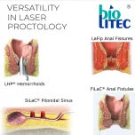 LHP®, SiLaC®, FiLaC®, Proctology Laser