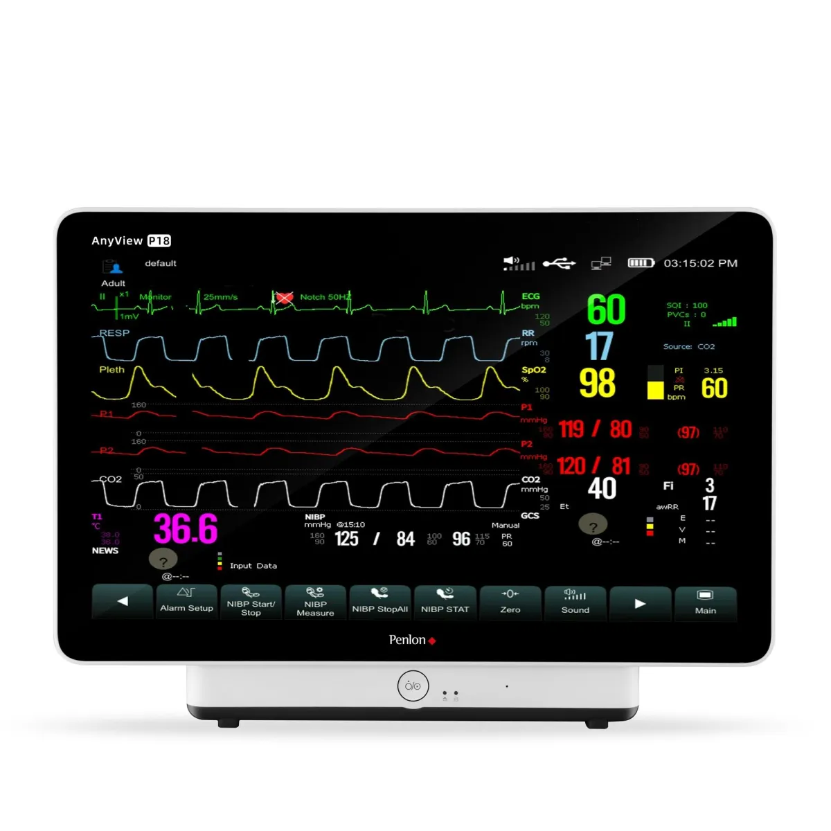 AnyView P18 Patient Monitor