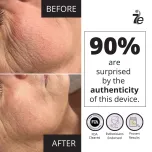 MyoLift Mini Microcurrent Facial Device - Non-Invasive Face Lift, Facial Skin Care Products for Anti Aging, Skin Tightening - Esthetician Supplies and Skin Care Tools - Up to 400 Microamps