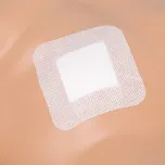 Wound Dressing, Transparent Dressing