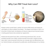 PRP Tube for Hair Regrowth