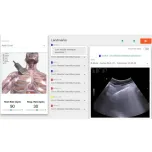 VAUSSIM - Create your Ultrasound Simulator