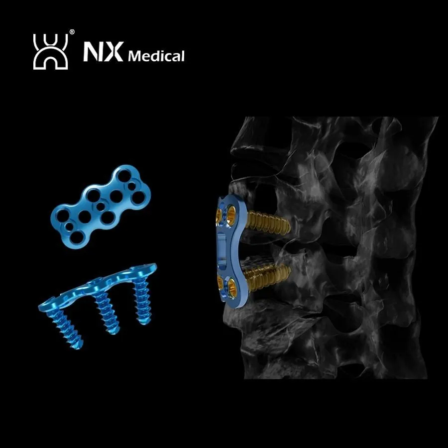 Orthopedic Implant for Spine