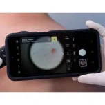 DICOM Camera - Capture to PACS