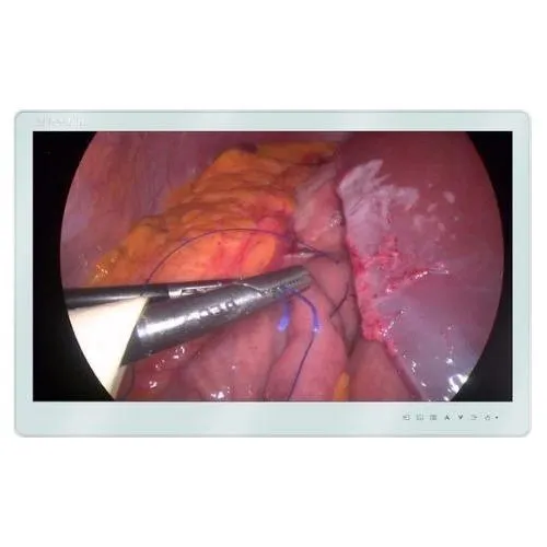 27 inch FHD Premium-quality Surgical Monitor MS270P