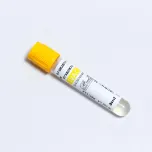 Blood Collection Tubes (Vacuum Tubes)