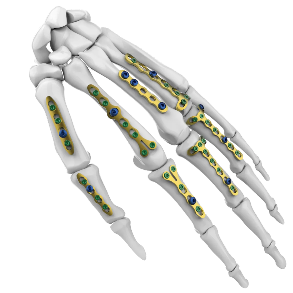 Hand System