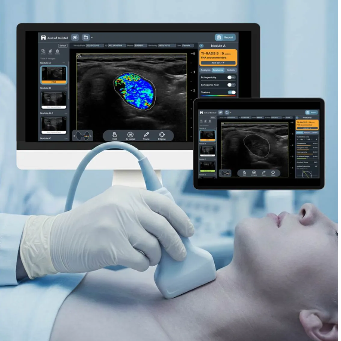 AmCAD-UT, Real-time AI-assisted Thyroid Ultrasound Assessment