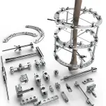 External Fixtator