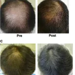 Hir Growth Supplement: BEROOT / Male Vitality Support NKUP for Men