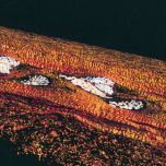 Omniflow® II Vascular Prosthesis