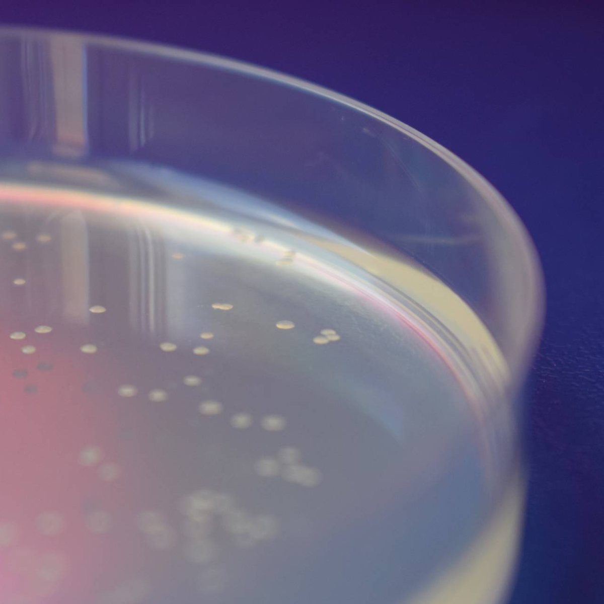 Bacterial Protein Expression
