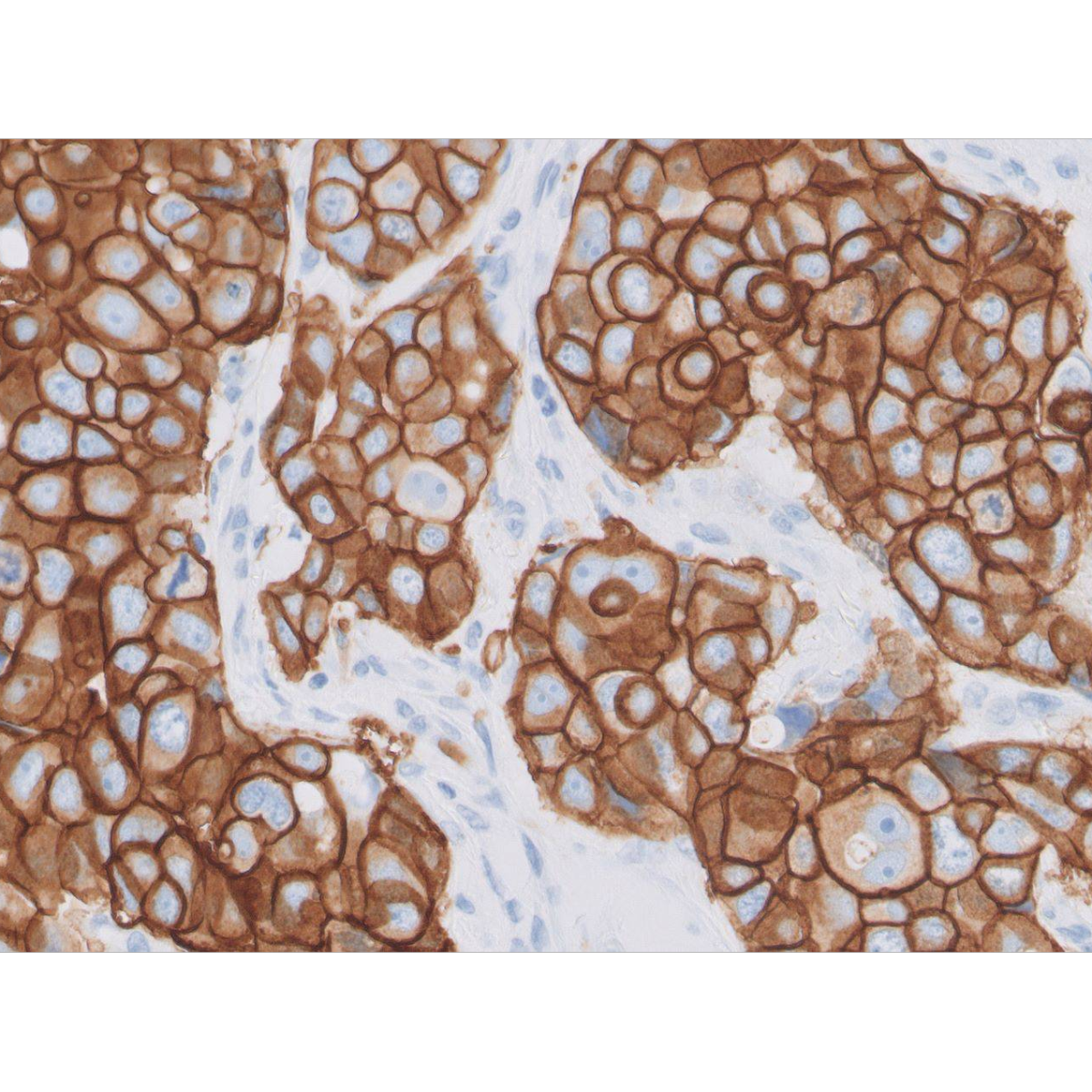 HercepTest™ mAb pharmDx