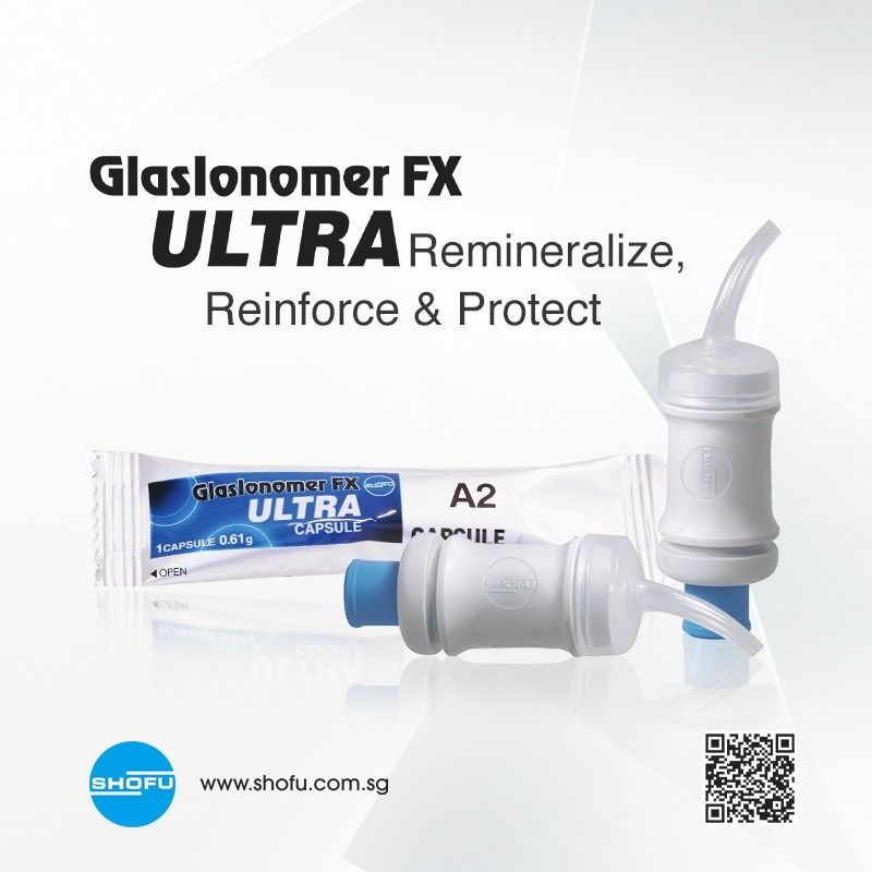 GLASIONOMER FX UTRA CAPSULES