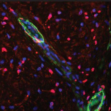 Angiogenesis in vitro to in vivo toolbox