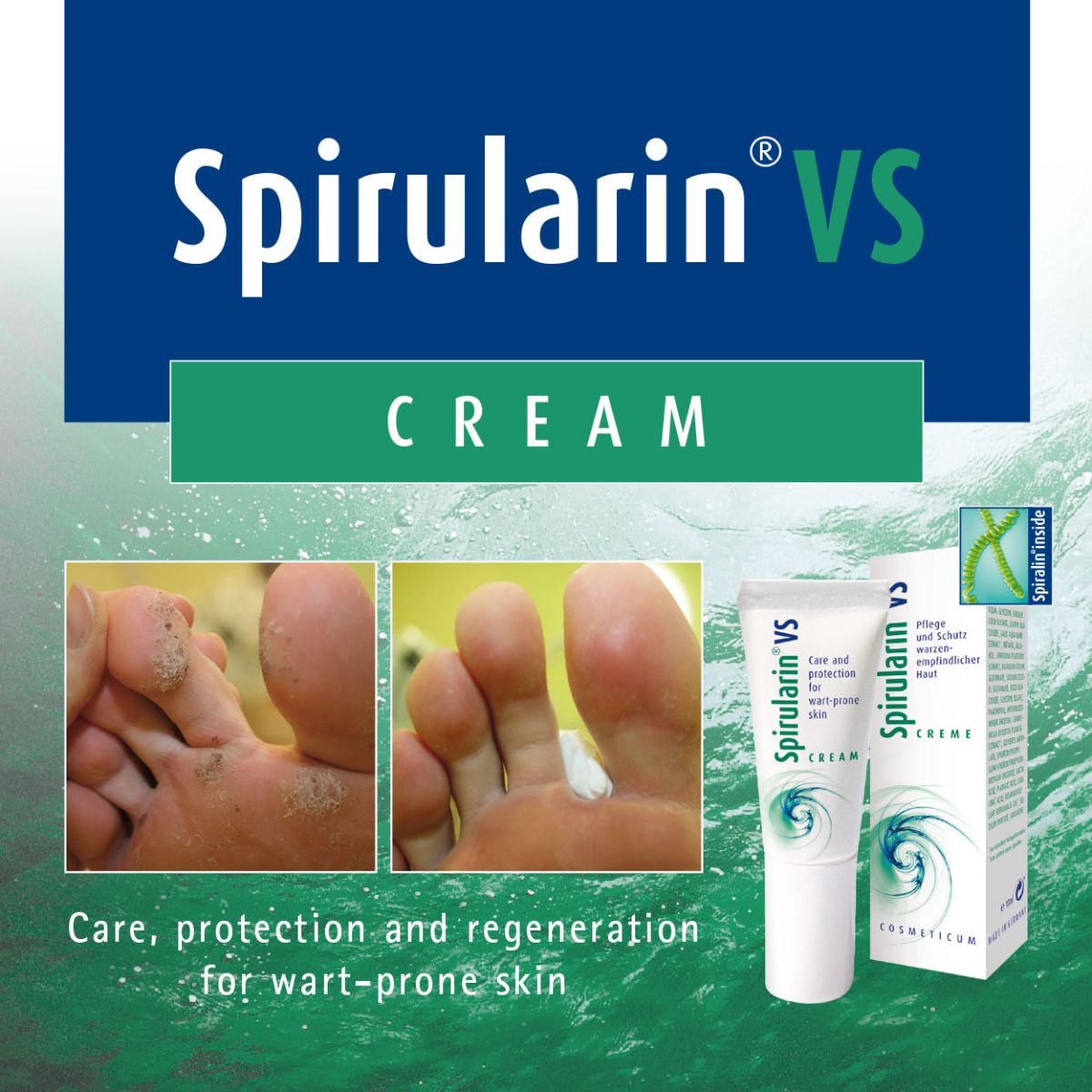 Spirularin VS Care and protection from warts