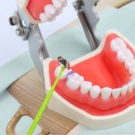 Dental Sectional Contoured Matrices Kits